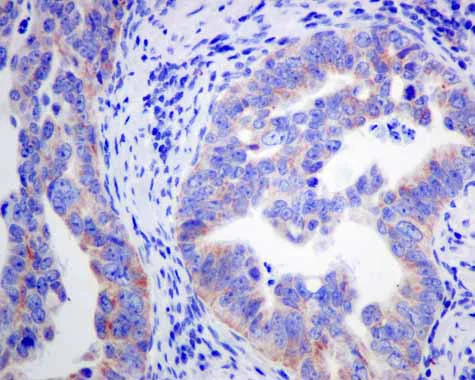 Immunohistochemistry (Formalin/PFA-fixed paraffin-embedded sections) - Anti-ACADS/SCAD antibody [EPR10862(B)] (AB156571)