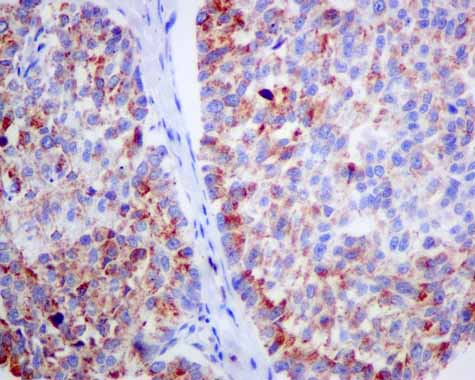 Immunohistochemistry (Formalin/PFA-fixed paraffin-embedded sections) - Anti-ACADS/SCAD antibody [EPR10862(B)] (AB156571)