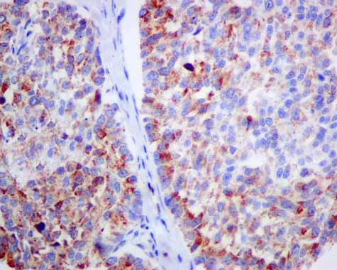 Immunohistochemistry (Formalin/PFA-fixed paraffin-embedded sections) - Anti-ACADS/SCAD antibody [EPR10862(B)] (AB156571)
