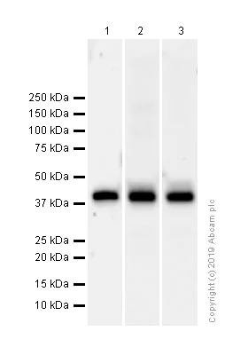 Western blot - Anti-ACADS/SCAD antibody [EPR10862(B)] (AB156571)