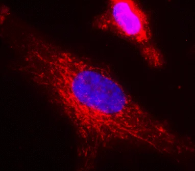Immunocytochemistry/ Immunofluorescence - Anti-ACADVL/VLCAD antibody [6A9AF2] (AB110285)