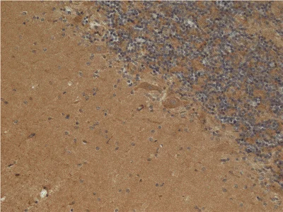 Immunohistochemistry (Formalin/PFA-fixed paraffin-embedded sections) - Anti-ACADVL/VLCAD antibody [6A9AF2] (AB110285)