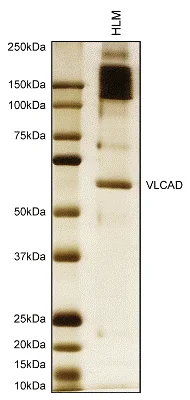 Immunoprecipitation - Anti-ACADVL/VLCAD antibody [6A9AF2] (AB110285)