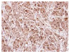Immunohistochemistry (Formalin/PFA-fixed paraffin-embedded sections) - Anti-ACADVL/VLCAD antibody (AB155138)