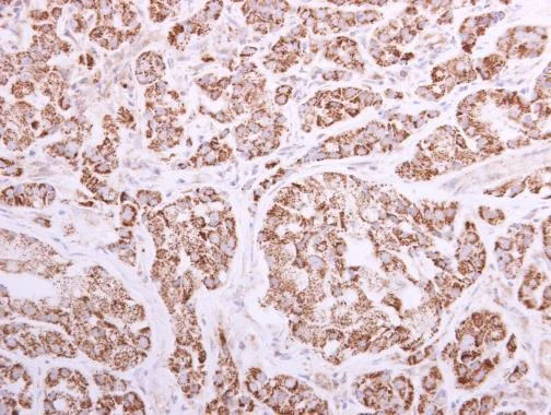 Immunohistochemistry (Formalin/PFA-fixed paraffin-embedded sections) - Anti-ACADVL/VLCAD antibody (AB155138)