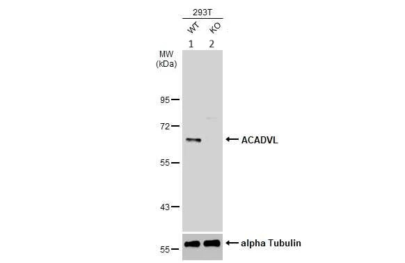 Western blot - Anti-ACADVL/VLCAD antibody (AB155138)