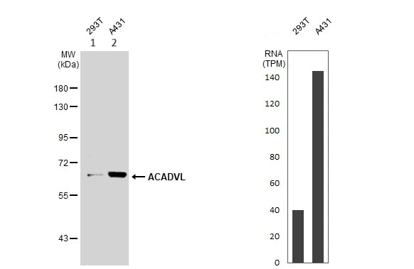 Western blot - Anti-ACADVL/VLCAD antibody (AB155138)