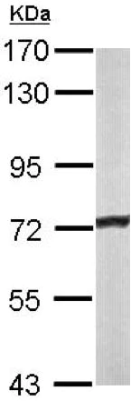 Western blot - Anti-ACADVL/VLCAD antibody (AB155138)