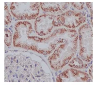 Immunohistochemistry (Formalin/PFA-fixed paraffin-embedded sections) - Anti-ACADVL/VLCAD antibody [EPR15107(B)] (AB188872)