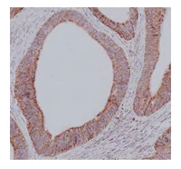 Immunohistochemistry (Formalin/PFA-fixed paraffin-embedded sections) - Anti-ACADVL/VLCAD antibody [EPR15107(B)] (AB188872)