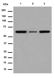 Western blot - Anti-ACADVL/VLCAD antibody [EPR15107(B)] (AB188872)