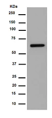 Western blot - Anti-ACADVL/VLCAD antibody [EPR15107(B)] (AB188872)