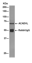 Immunoprecipitation - Anti-ACADVL/VLCAD antibody [EPR15107(B)] - BSA and Azide free (AB231827)