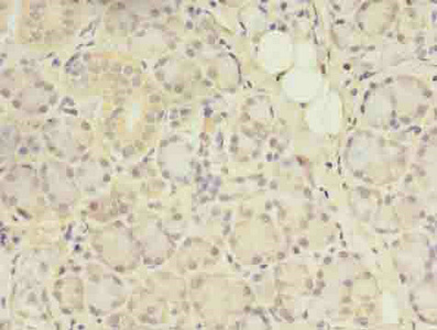 Immunohistochemistry (Formalin/PFA-fixed paraffin-embedded sections) - Anti-ACAP1 antibody (AB235827), expandable thumbnail