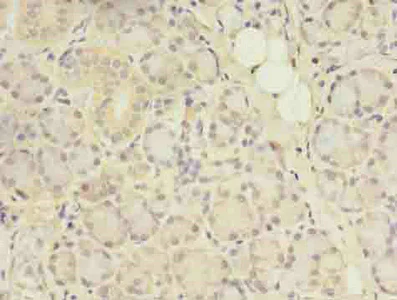 Immunohistochemistry (Formalin/PFA-fixed paraffin-embedded sections) - Anti-ACAP1 antibody (AB235827)