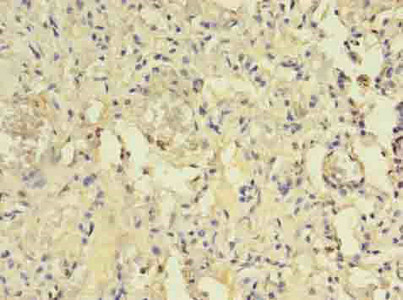 Immunohistochemistry (Formalin/PFA-fixed paraffin-embedded sections) - Anti-ACAP1 antibody (AB235827), expandable thumbnail