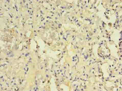 Immunohistochemistry (Formalin/PFA-fixed paraffin-embedded sections) - Anti-ACAP1 antibody (AB235827)