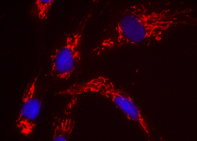 Immunocytochemistry - Anti-ACAT1 antibody [9H10AB4] (AB110290), expandable thumbnail