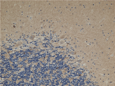 Immunohistochemistry (Formalin/PFA-fixed paraffin-embedded sections) - Anti-ACAT1 antibody [9H10AB4] (AB110290), expandable thumbnail