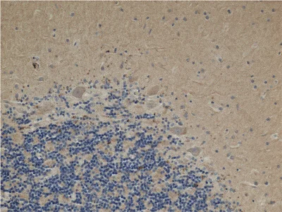 Immunohistochemistry (Formalin/PFA-fixed paraffin-embedded sections) - Anti-ACAT1 antibody [9H10AB4] (AB110290)