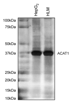 Immunoprecipitation - Anti-ACAT1 antibody [9H10AB4] (AB110290), expandable thumbnail