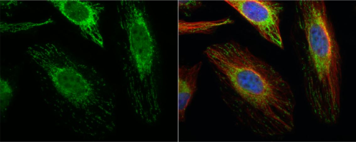 Immunocytochemistry/ Immunofluorescence - Anti-ACAT1 antibody (AB154396), expandable thumbnail