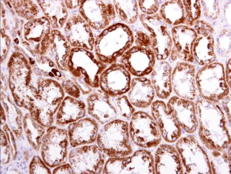Immunohistochemistry (Formalin/PFA-fixed paraffin-embedded sections) - Anti-ACAT1 antibody (AB154396)