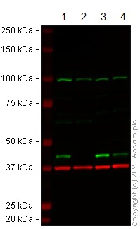 Western blot - Anti-ACAT1 antibody (AB154396), expandable thumbnail