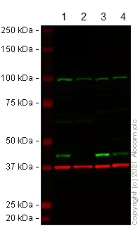 Western blot - Anti-ACAT1 antibody (AB154396)
