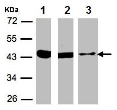 Western blot - Anti-ACAT1 antibody (ab154396), expandable thumbnail