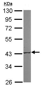 Western blot - Anti-ACAT1 antibody (ab154396), expandable thumbnail