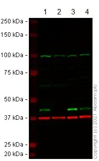 Western blot - Anti-ACAT1 antibody (AB154396), expandable thumbnail