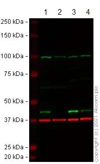 Western blot - Anti-ACAT1 antibody (AB154396)