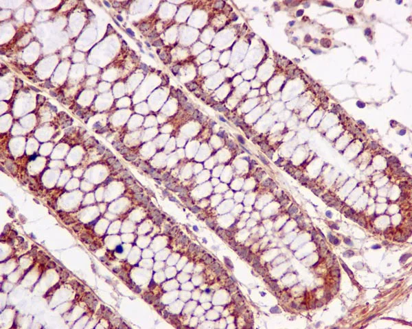 Immunohistochemistry (Formalin/PFA-fixed paraffin-embedded sections) - Anti-ACAT1 antibody [EPR10359] (AB168342)