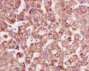 Immunohistochemistry (Formalin/PFA-fixed paraffin-embedded sections) - Anti-ACAT1 antibody [EPR10359] (ab168342), expandable thumbnail