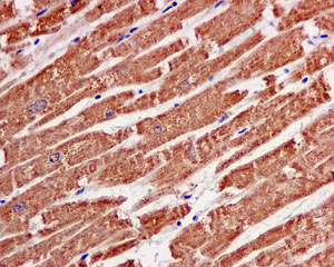 Immunohistochemistry (Formalin/PFA-fixed paraffin-embedded sections) - Anti-ACAT1 antibody [EPR10359] (ab168342), expandable thumbnail
