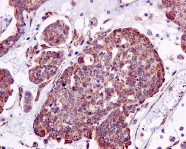 Immunohistochemistry (Formalin/PFA-fixed paraffin-embedded sections) - Anti-ACAT1 antibody [EPR10359] (AB168342), expandable thumbnail