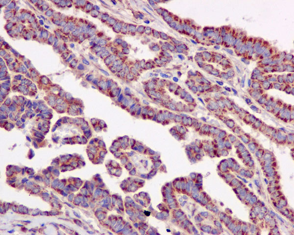 Immunohistochemistry (Formalin/PFA-fixed paraffin-embedded sections) - Anti-ACAT1 antibody [EPR10359] (ab168342), expandable thumbnail