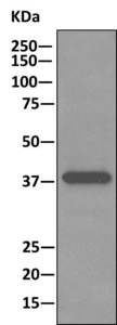Immunoprecipitation - Anti-ACAT1 antibody [EPR10359] (ab168342), expandable thumbnail
