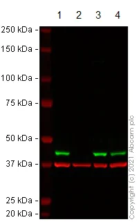 Western blot - Anti-ACAT1 antibody [EPR10359] (AB168342)