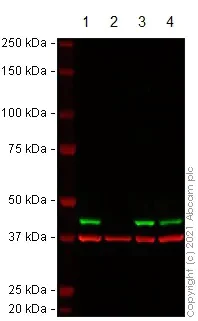 Western blot - Anti-ACAT1 antibody [EPR10359] (AB168342)
