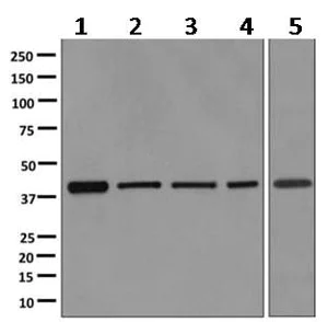 Western blot - Anti-ACAT1 antibody [EPR10359] (AB168342)