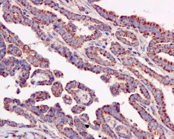 Immunohistochemistry (Formalin/PFA-fixed paraffin-embedded sections) - Anti-ACAT1 antibody [EPR10359] - BSA and Azide free (AB240152)