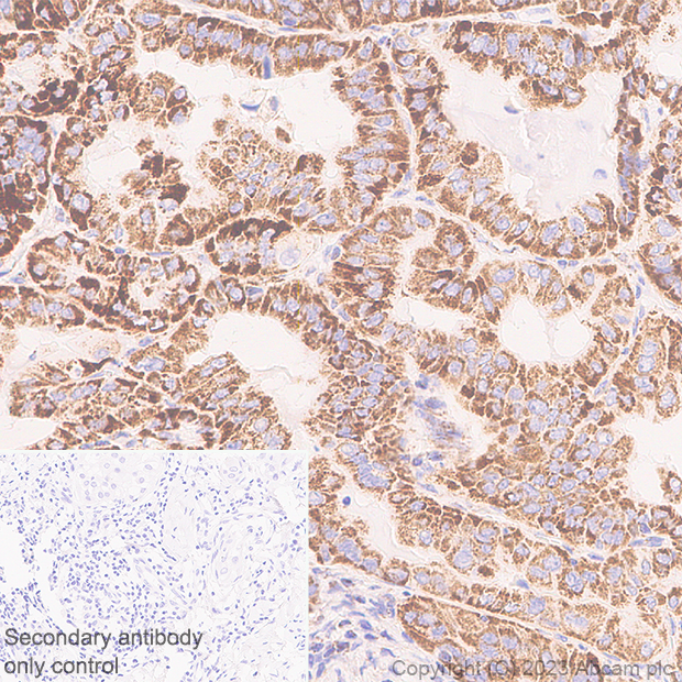 Immunohistochemistry (Formalin/PFA-fixed paraffin-embedded sections) - Anti-ACAT1 antibody [EPR28035-8] (AB312320)