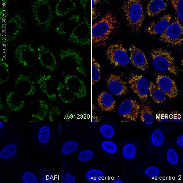 Immunocytochemistry/ Immunofluorescence - Anti-ACAT1 antibody [EPR28035-8] - BSA and Azide free (AB312321)
