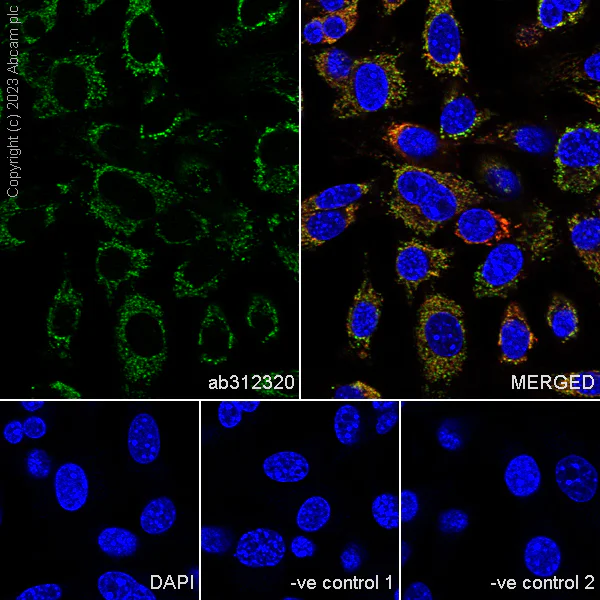 Immunocytochemistry/ Immunofluorescence - Anti-ACAT1 antibody [EPR28035-8] - BSA and Azide free (AB312321)