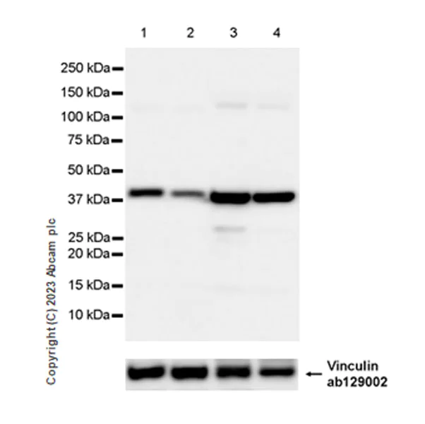 Western blot - Anti-ACAT1 antibody [EPR28035-8] - BSA and Azide free (AB312321)