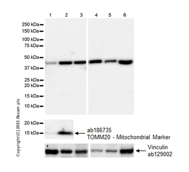 Western blot - Anti-ACAT1 antibody [EPR28035-8] - BSA and Azide free (AB312321)