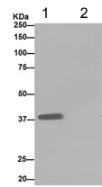 Immunoprecipitation - Anti-ACAT2/Acetyl-CoA acetyltransferase antibody [EPR8416(2)] (AB191431)