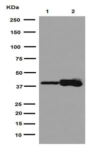 Western blot - Anti-ACAT2/Acetyl-CoA acetyltransferase antibody [EPR8416(2)] (AB191431)
